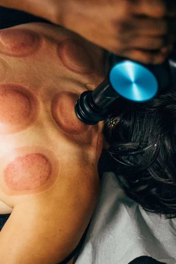 Pistolet de massage sur l’épaule, marques de ventouses